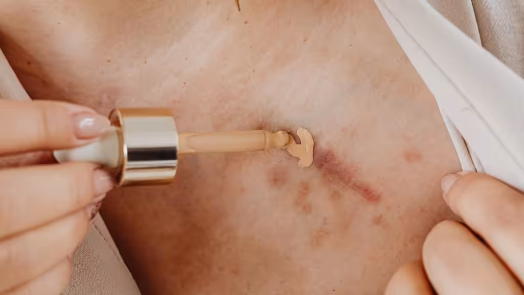 Tratamientos quirúrgicos para cicatrices graves