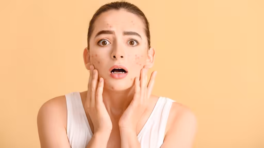 ¿Qué relación hay entre el estrés y la salud de la piel