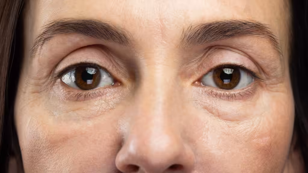 Exposición al sol principal causa del envejecimiento prematuro