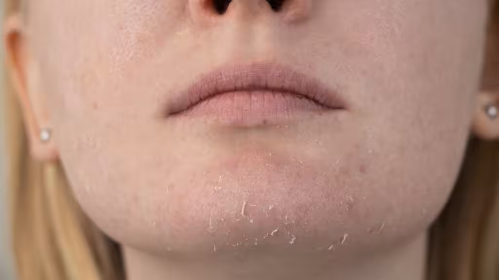 Limpieza facial adecuada para piel seca