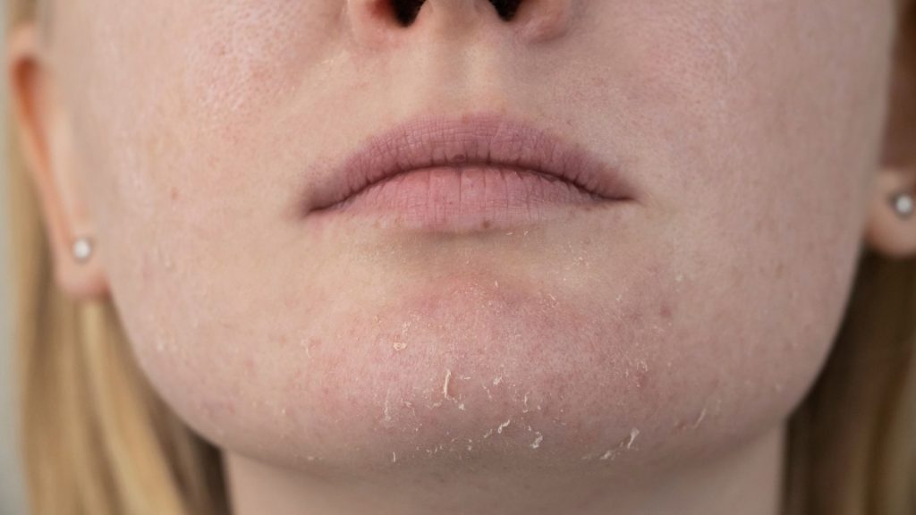 Limpieza facial adecuada para piel seca
