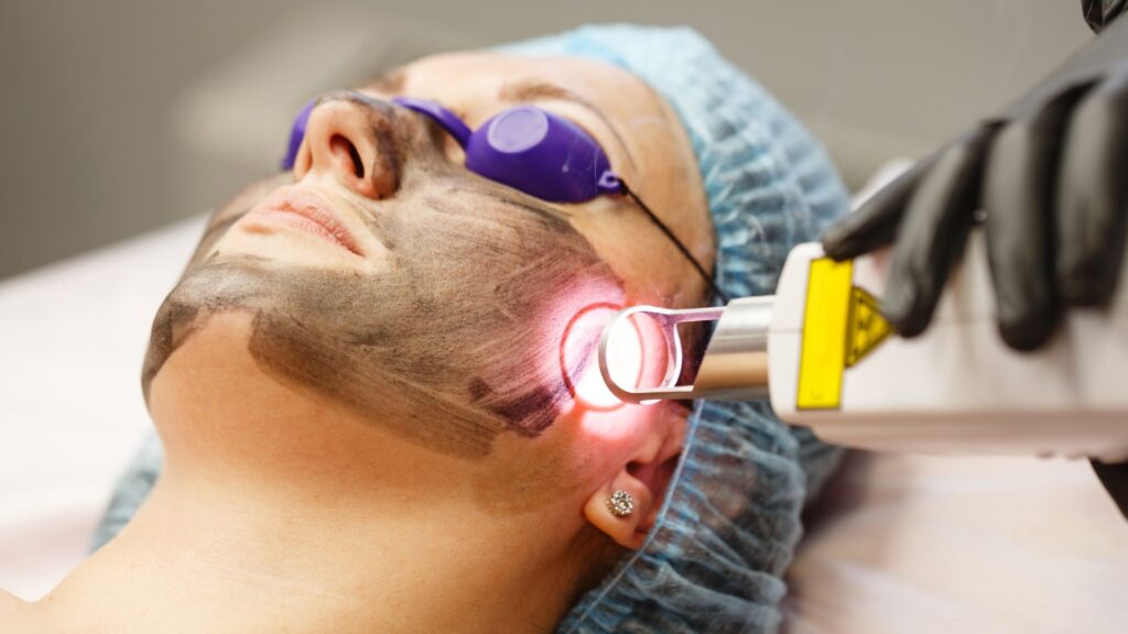 Como realizar un peeling