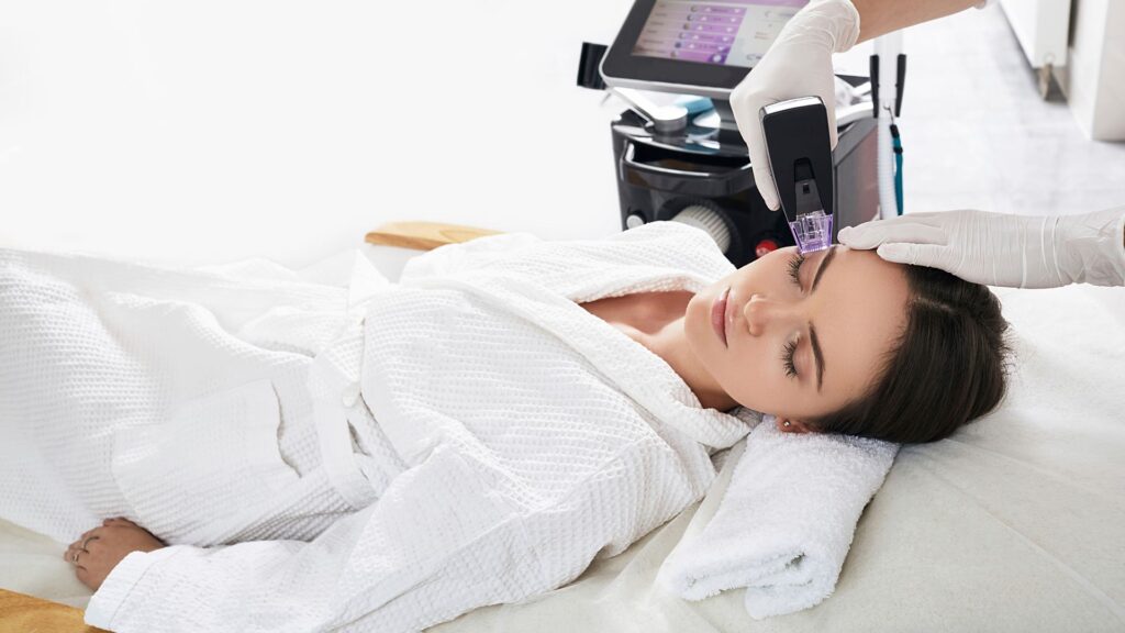 Beneficios de la Radiofrecuencia Facial