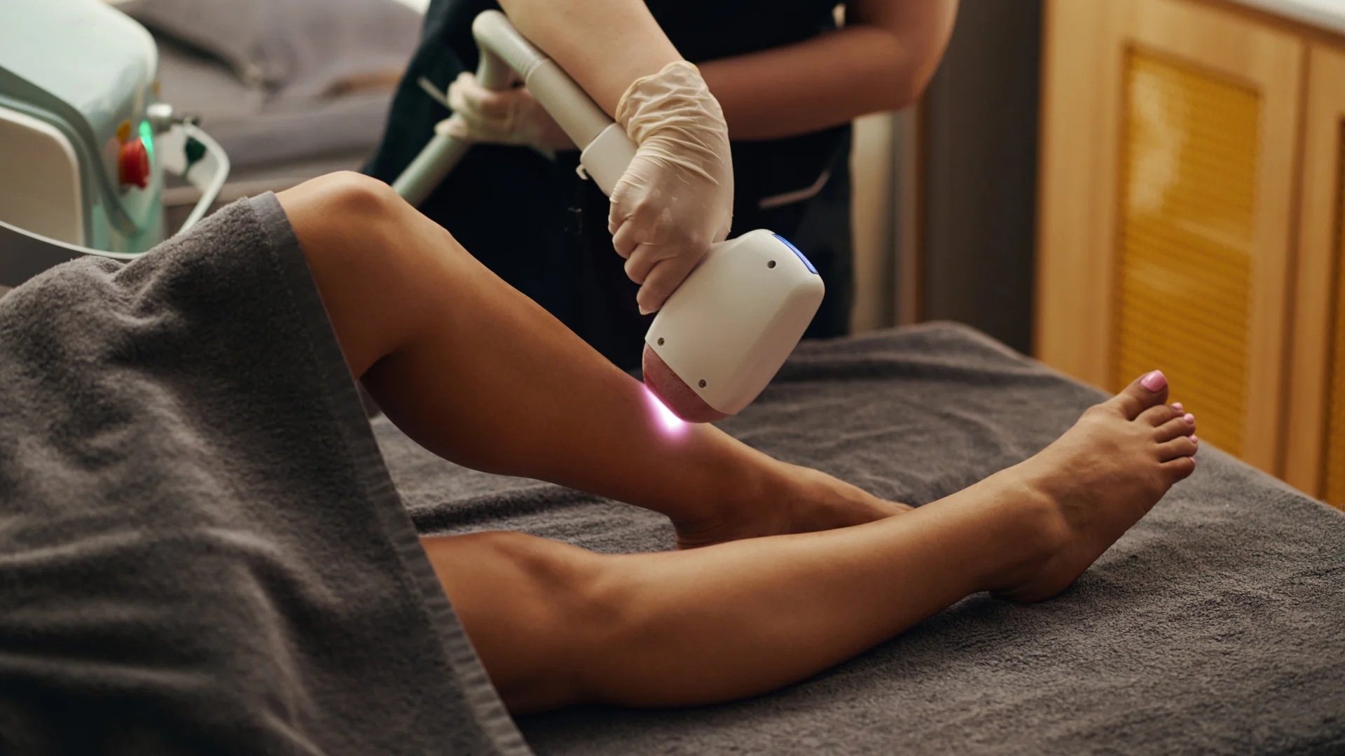 Beneficios de la depilación laser